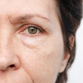 Włóż to do zamrażarki, a zapomnisz o workach pod oczami. Znikną w sekundę